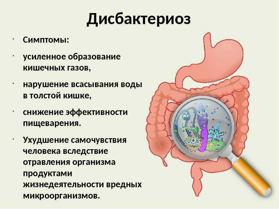 Дисбактериоз и дисбиоз кишечника: причины, симптомы и диагностика