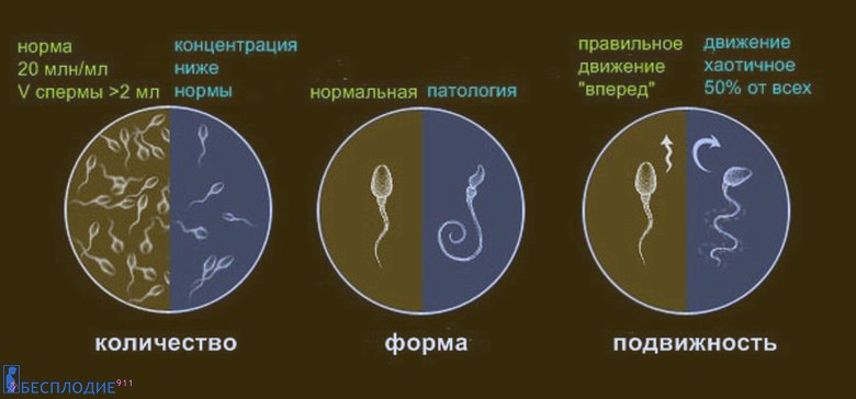 Цвет спермы норма: Основные параметры базовой спермограммы