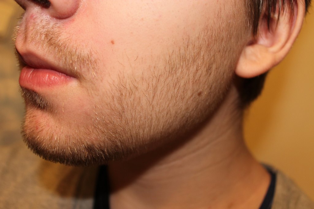 Как подростку отрастить бороду: Как ускорить рост бороды в 16 лет подростку?