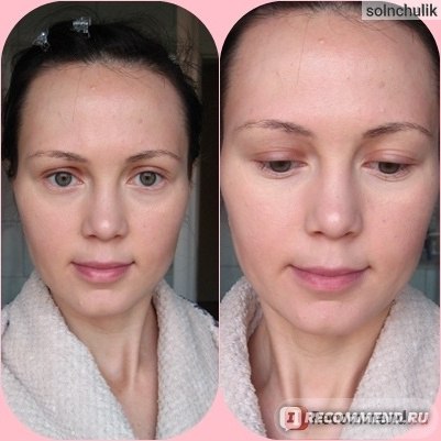 Спрей BIO-H-TIN Pharma  MINOXIDIL 20 mg/ml Spray Lsg фото