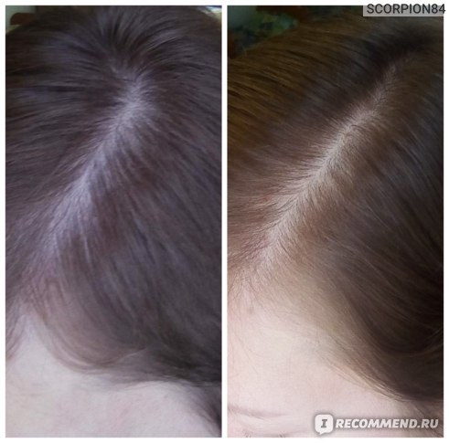 Слева-состояние волос в начале применения, справа-через 4 месяца