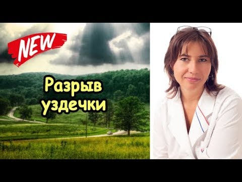 Где уздечка на головке: Что такое «уздечка» у мужчин, расположение и решение проблем с ней