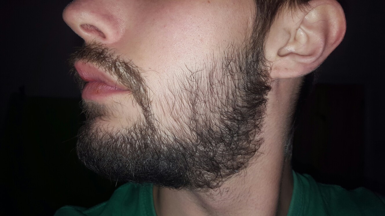 Как отрастить быстро бороду в 17 лет: 5 быстрых и правильных способов от докторов