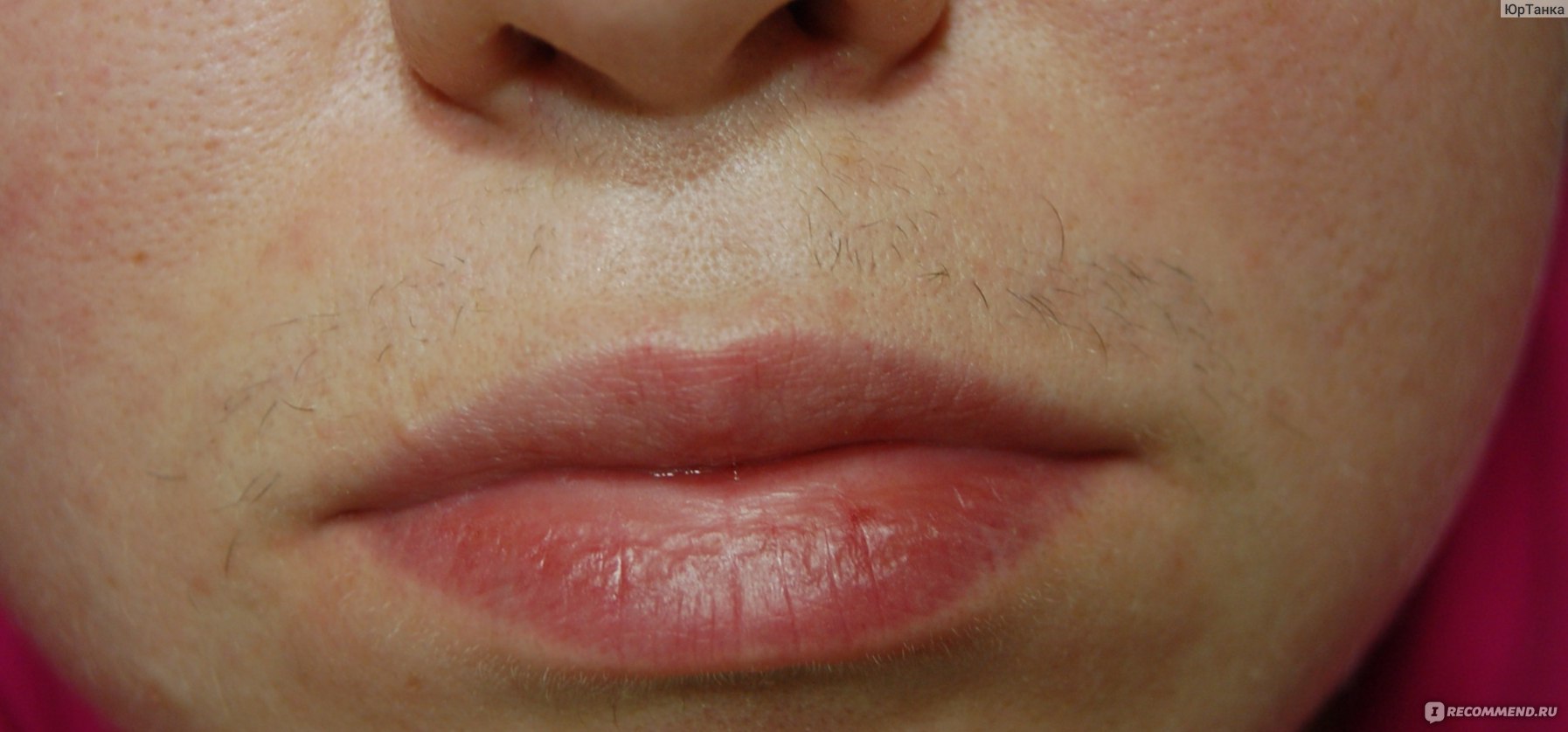 Как удалить усы у женщин навсегда в домашних условиях: Как убрать усики девушке: безопасные способы удаления волос над губой