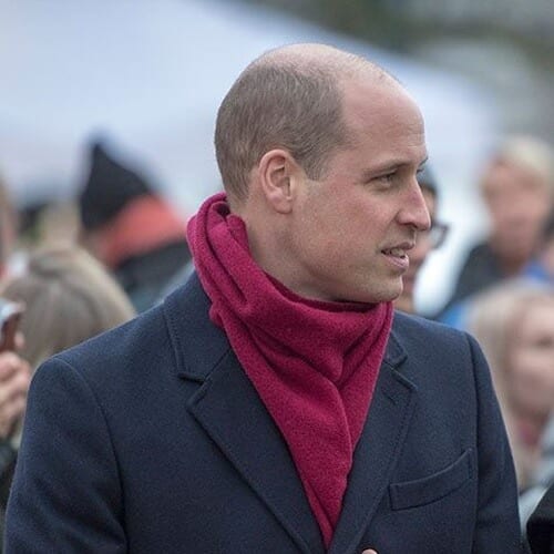 Prince William Haircuts for Bald Spot on Crown