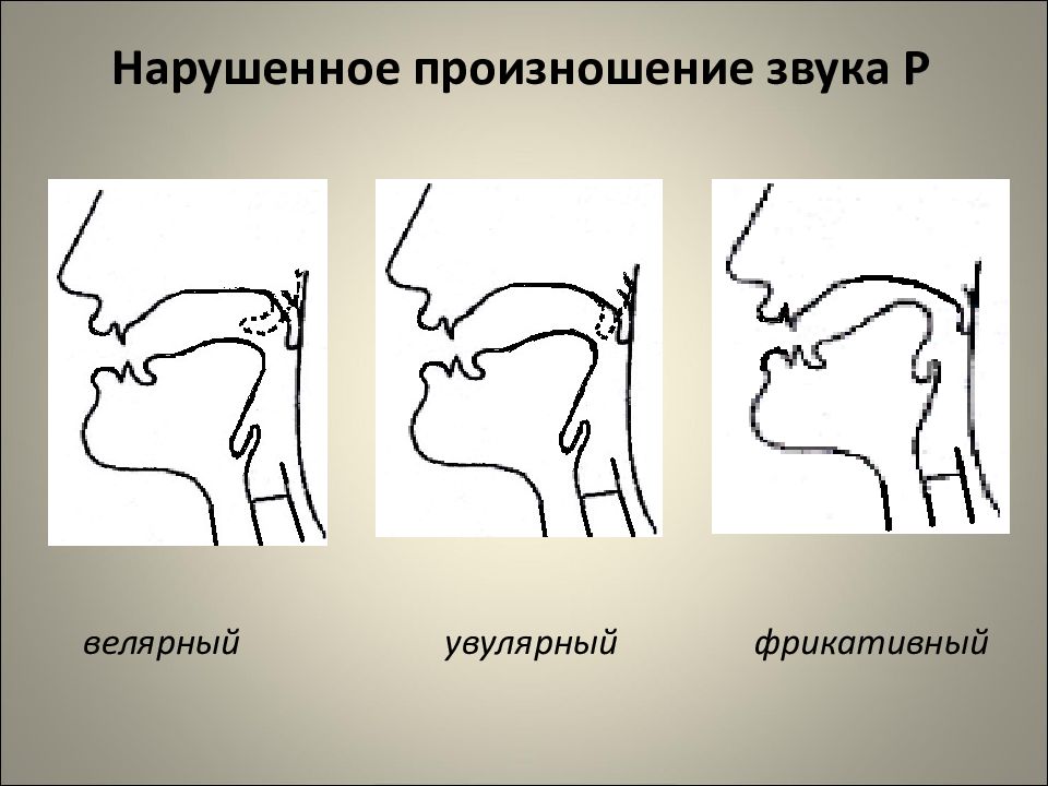 Произношение звука Р: подробное руководство по постановке и автоматизации