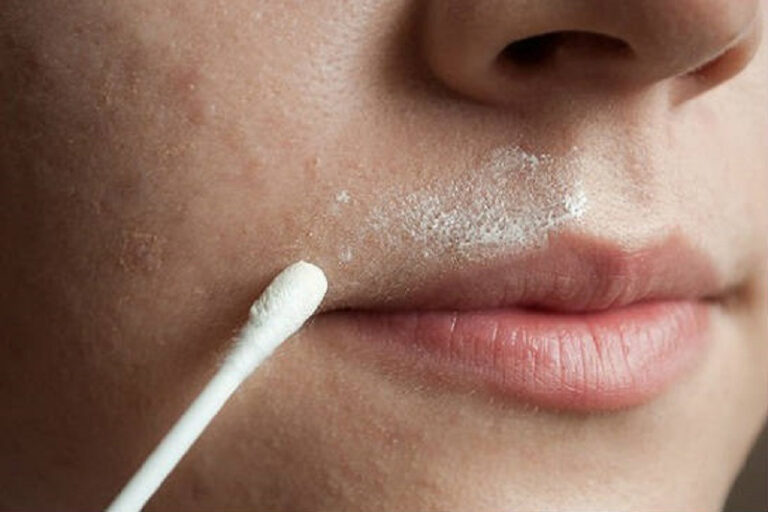 Как удалить усы у женщин навсегда в домашних условиях: Как убрать усики девушке: безопасные способы удаления волос над губой