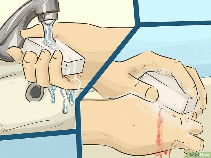 Как остановить кровь от пореза бритвой: Как и чем остановить кровь при порезе (глубоком, сильном, бритвой)