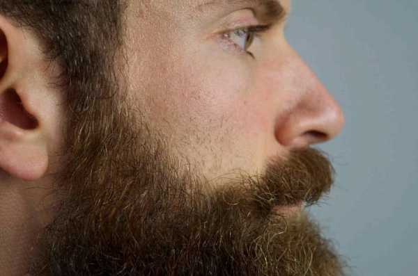 Борода кусками растет – Если борода растет кусками что делать и как бороться?