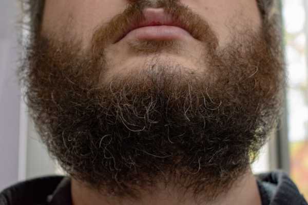 Борода не ровно растет – Как понять что начала расти борода у подростка