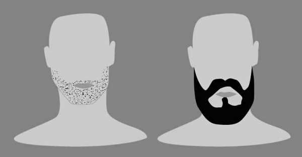 Борода шотландка – как выглядит (фото) и как сделать?