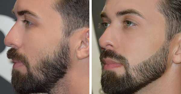 Бороды модели – Смотри! Модная борода 2018-2019 у мужчин 150 фото с усами и без