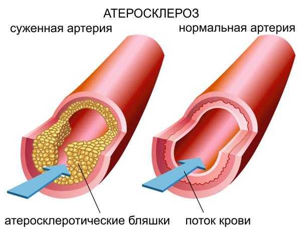 Что делать если муж не хочет жену советы психолога – |