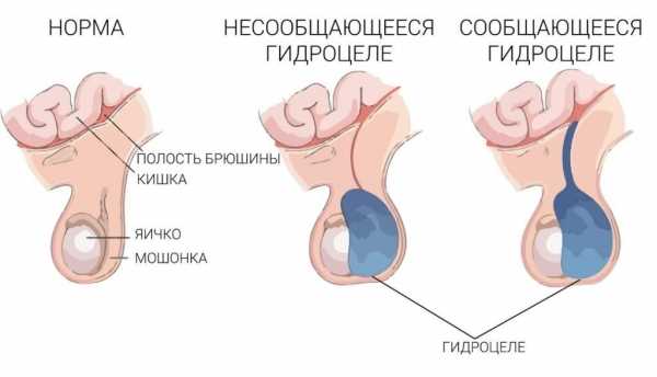 Что влияет на размер мужских яичек – Нормальный размер яичек у мужчин и мальчиков (таблица): от чего зависит