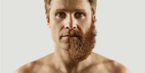 Чтобы борода гуще росла – Почему щетина плохо растет и как сделать бороду гуще?