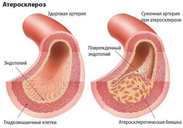 Если по утрам не стоит что делать – причины и что делать, если не встает!