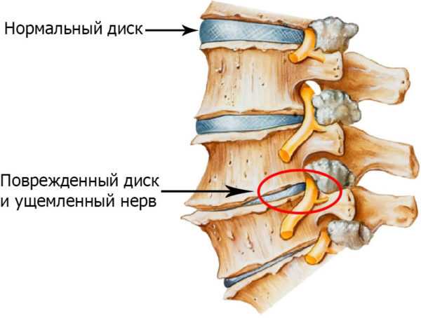 Если по утрам не стоит что делать – причины и что делать, если не встает!