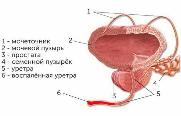 Фото уретрита у мужчин фото – фото, симптомы и лечение с помощью препаатов