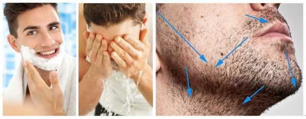 Как бриться чтобы не было раздражения у мужчин – 10 советов как правильно бриться мужчине