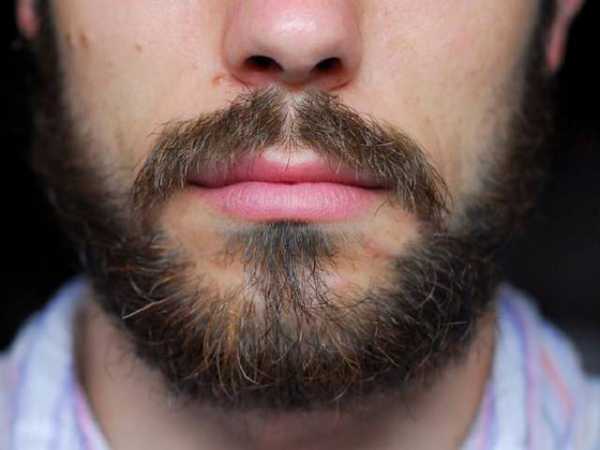 Как быстро отрастить бороду в 16 лет – когда начинает расти борода на лице подростка, как ускорить рост щетины в подростковом возрасте, а также почему это не происходит и от чего зависит?