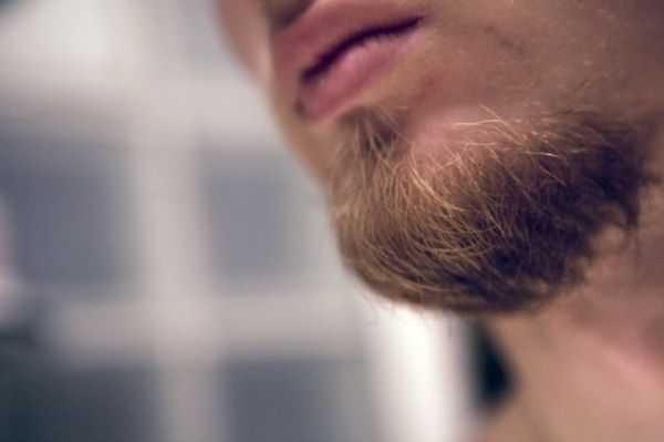 Как быстро вырастить волосы на лице – Как ускорить рост бороды естественным способом?
