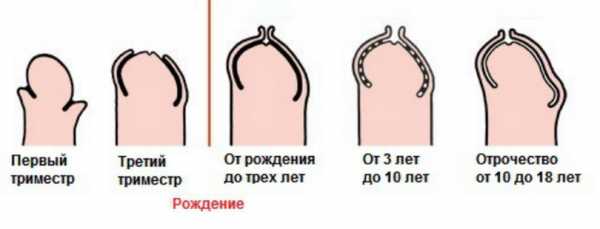 Как должна открываться головка у мальчиков фото в 2 года – Как должна открываться головка у мальчиков фото в 2 года