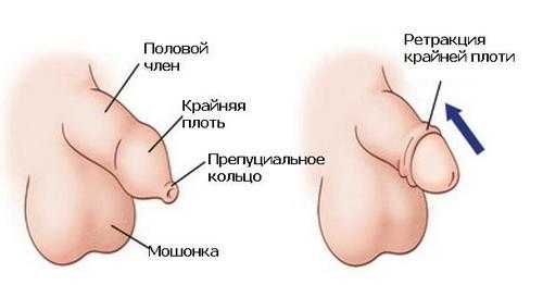 Как должна открываться головка у мальчиков фото в 2 года – Как должна открываться головка у мальчиков фото в 2 года