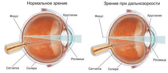 Как подобрать правильно очки – Как выбрать очки для зрения, правильно подобрать их и проверить