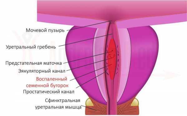 Как продлить пол акт – 20 крутых советов на тему о том, как хорошенько продлить половой акт мужчины в домашних условиях