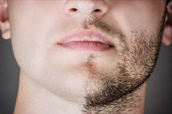 Как вызвать рост бороды – Как ускорить рост бороды естественным способом?