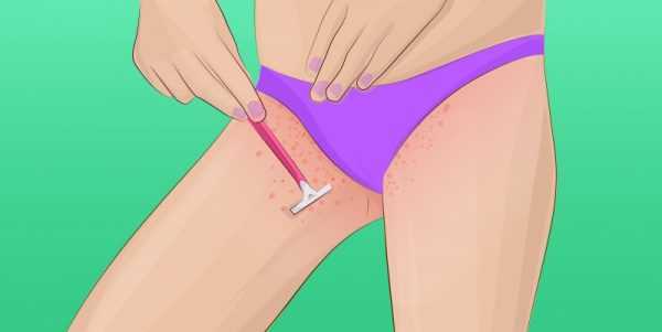 Крем против раздражения после бритья – Как избавиться от раздражения после бритья? Эффективные и популярные средства
