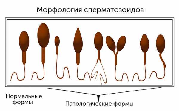 От чего много спермы – Почему у кого-то выделяется много спермы?