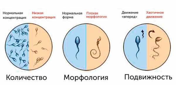 От чего много спермы – Почему у кого-то выделяется много спермы?