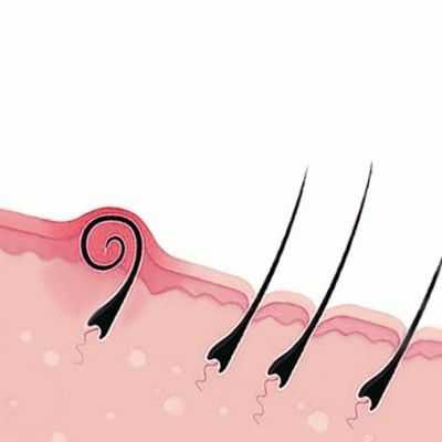 Почему в паху растут волосы – Почему растут волосы в паху: немного об анатомии человека