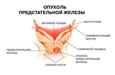Предстательная железа простата – : , ,