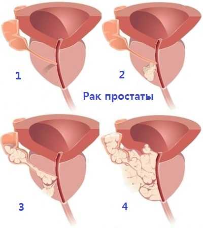 Предстательная железа простата – : , ,