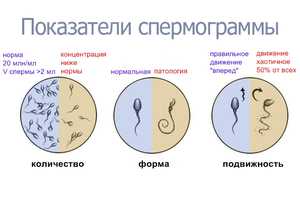 При эякуляции мало спермы – Почему у мужчины выделяется мало спермы: причины и что делать