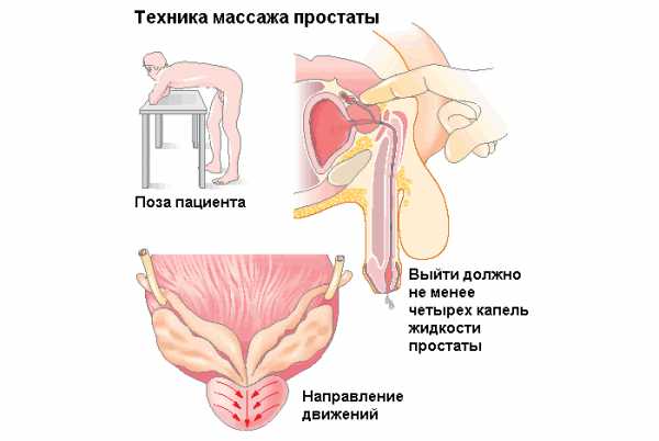 Простата это – : , ,