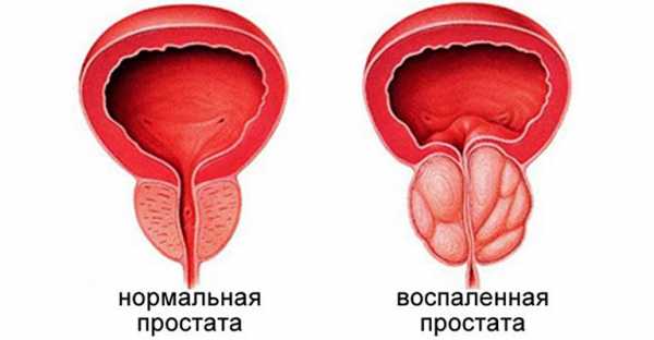 Простата и предстательная железа это одно и тоже – это одно и то же или нет и как произошли данные термины