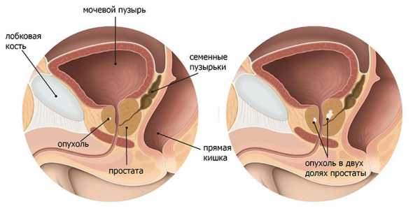 Простата и предстательная железа это одно и тоже – это одно и то же или нет и как произошли данные термины