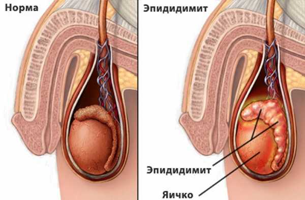 Размер мужских яичек норма фото – Размер яичек у мужчин норма патология размер причины устройство органа