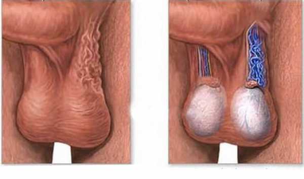 Размер мужских яичек норма фото – Размер яичек у мужчин норма патология размер причины устройство органа