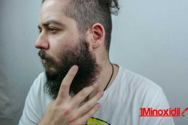 Скорость роста бороды – Сколько по времени и как растет борода у мужчин?