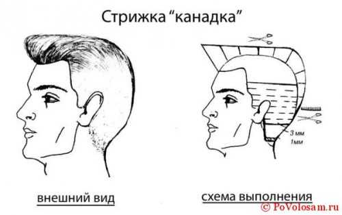 Стрижка канадка короткая мужская – Ой!