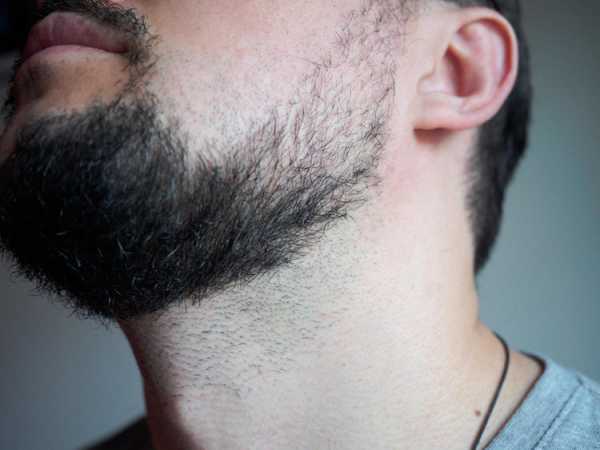 Триммер philips – Триммеры для бороды, носа и ушей, стайлеры